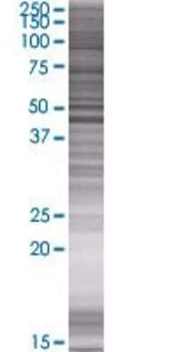 Abnova AACS 293T Cell Transient Overexpression Lysate (Denatured) 100 &mu;L | Buy Online | Abnova&trade; | Fisher Scientific