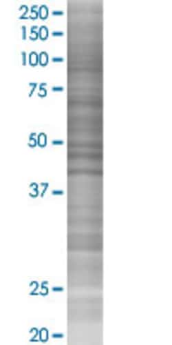 Abnova AHNAK 293T Cell Transient Overexpression Lysate (Denatured) 100 &mu;L | Buy Online | Abnova&trade; | Fisher Scientific