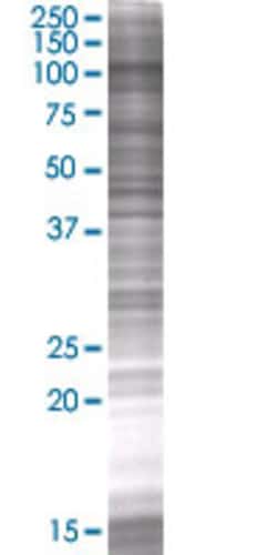 Abnova SECISBP2 293T Cell Transient Overexpression Lysate (Denatured) 100 &mu;L | Buy Online | Abnova&trade; | Fisher Scientific
