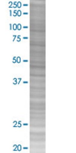 Abnova WDR77 293T Cell Transient Overexpression Lysate (Denatured) (T02) 100 &mu;L | Buy Online | Abnova&trade; | Fisher Scientific
