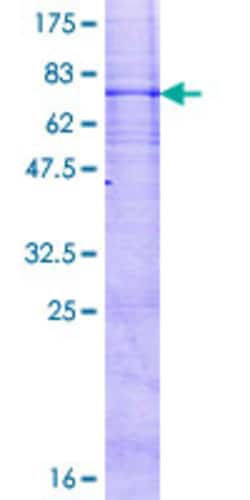 Abnova Human RNF26 Full-length ORF (NP_114404.1, 1 a.a. - 433 a.a.) Recombinant Protein with GST-tag at N-terminal 2 &mu;g | Buy Online | Abnova&trade; | Fisher Scientific