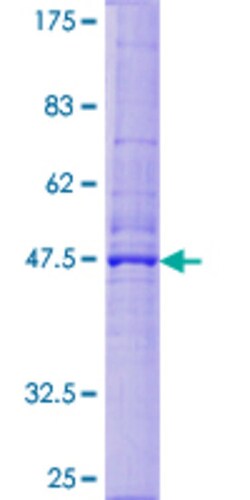 Abnova™ Human DERL1 Full-length ORF (NP_077271.1, 1 a.a. - 251 a.a.) Recombinant Protein with GST-tag at N-terminal