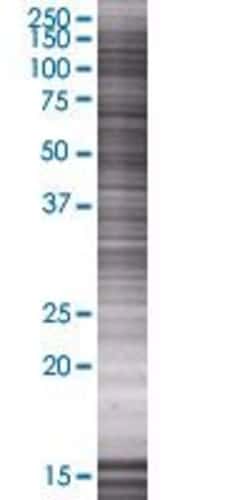Abnova BRCC3 293T Cell Transient Overexpression Lysate (Denatured) 100 &mu;L | Buy Online | Abnova&trade; | Fisher Scientific