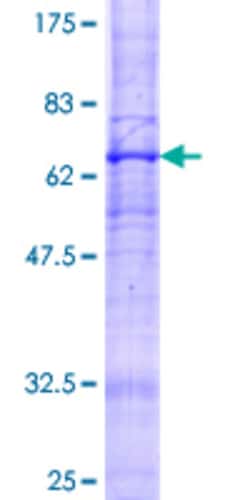Abnova Human ADIPOR2 Full-length ORF (NP_078827.2, 1 a.a. - 386 a.a.) Recombinant Protein with GST-tag at N-terminal 2 &mu;g | Buy Online | Abnova&trade; | Fisher Scientific