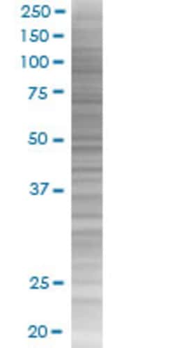 Abnova&trade;&nbsp;C1orf54 (1-131) 293T Cell Transient Overexpression Lysate (Denatured)