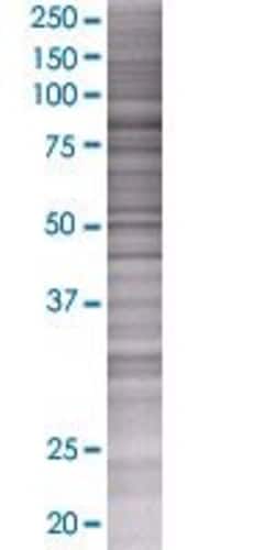 Abnova ZNF668 293T Cell Transient Overexpression Lysate (Denatured) 100 &mu;l | Buy Online | Abnova&trade; | Fisher Scientific