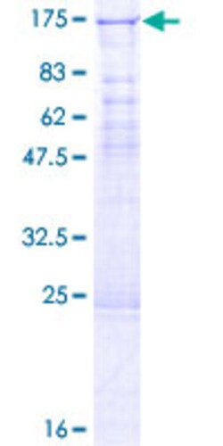 Abnova Human EHMT1 Full-length ORF (AAH47504.1, 1 a.a. - 808 a.a.) Recombinant Protein with GST-tag at N-terminal 2 &mu;g | Buy Online | Abnova&trade; | Fisher Scientific