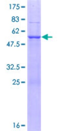 Abnova Human NAT11 Full-length ORF (AAH52298.1, 1 a.a. - 237 a.a.) Recombinant Protein with GST-tag at N-terminal 10 &mu;g | Buy Online | Abnova&trade; | Fisher Scientific