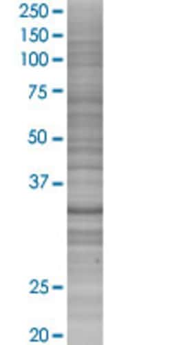 Abnova ZC3H14 293T Cell Transient Overexpression Lysate (Denatured) (T03) 100 &mu;L | Buy Online | Abnova&trade; | Fisher Scientific
