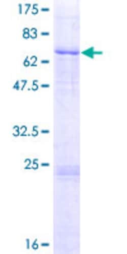 Abnova Human L2HGDH Full-length ORF (AAH06117.1, 1 a.a. - 441 a.a.) Recombinant Protein with GST-tag at N-terminal 2 &mu;g | Buy Online | Abnova&trade; | Fisher Scientific