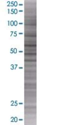 Abnova PDZD7 293T Cell Transient Overexpression Lysate (Denatured) 100 &mu;L | Buy Online | Abnova&trade; | Fisher Scientific