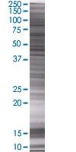 Abnova MOGAT2 293T Cell Transient Overexpression Lysate (Denatured) 100&mu;L | Buy Online | Abnova&trade; | Fisher Scientific