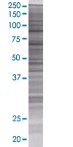 Abnova&trade;&nbsp;FBXO11 293T Cell Transient Overexpression Lysate (Denatured)
