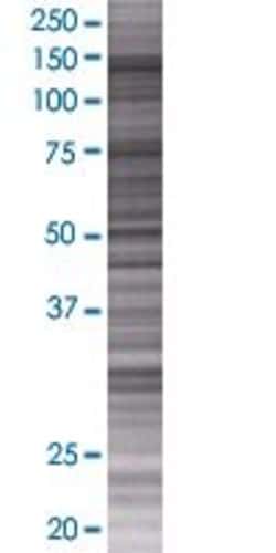 Abnova DEPDC2 293T Cell Transient Overexpression Lysate (Denatured) 100 &mu;L | Buy Online | Abnova&trade; | Fisher Scientific