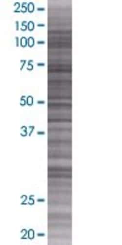 Abnova SLC35F5 293T Cell Transient Overexpression Lysate (Denatured) 100 &mu;L | Buy Online | Abnova&trade; | Fisher Scientific