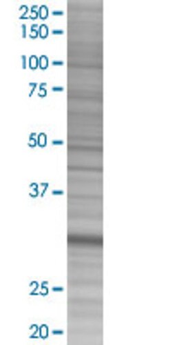 Abnova EFHD1 293T Cell Transient Overexpression Lysate (Denatured) (T02) 100 &mu;L | Buy Online | Abnova&trade; | Fisher Scientific