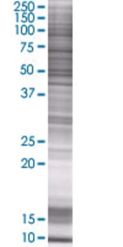 Abnova&trade;&nbsp;PNPLA3 293T Cell Transient Overexpression Lysate (Denatured)