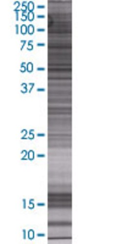 Abnova ACAD10 293T Cell Transient Overexpression Lysate (Denatured) 100 &mu;L | Buy Online | Abnova&trade; | Fisher Scientific
