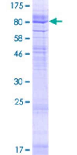 Abnova Human GDPD5 Full-length ORF (NP_110419.4, 1 a.a. - 605 a.a.) Recombinant Protein with GST-tag at N-terminal 2 &mu;g | Buy Online | Abnova&trade; | Fisher Scientific