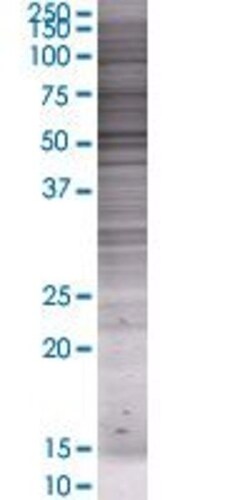 Abnova FBXO38 293T Cell Transient Overexpression Lysate (Denatured) 100 &mu;L | Buy Online | Abnova&trade; | Fisher Scientific