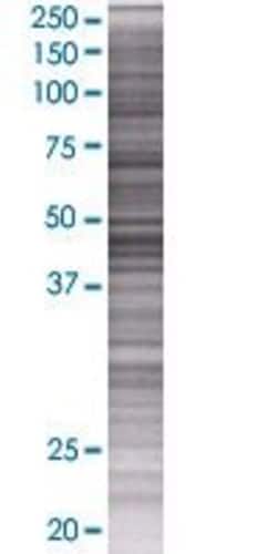Abnova WBSCR16 293T Cell Transient Overexpression Lysate (Denatured) (T01) 100 &mu;L | Buy Online | Abnova&trade; | Fisher Scientific