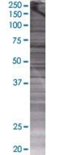 Abnova ACSBG2 293T Cell Transient Overexpression Lysate (Denatured) 100 &mu;L | Buy Online | Abnova&trade; | Fisher Scientific