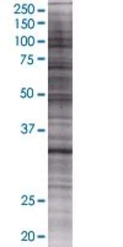 Abnova ABHD11 293T Cell Transient Overexpression Lysate (Denatured) 100 &mu;L | Buy Online | Abnova&trade; | Fisher Scientific