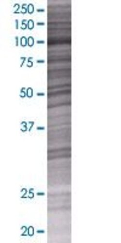 Abnova COG3 293T Cell Transient Overexpression Lysate (Denatured) 100&mu;L | Buy Online | Abnova&trade; | Fisher Scientific