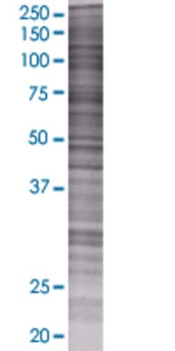 Abnova&trade;&nbsp;KIRREL2 293T Cell Transient Overexpression Lysate (Denatured) (T01)