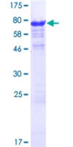 Abnova™ Human SLC7A6OS Full-length ORF (AAH13778.1, 1 a.a. - 309 a.a.) Recombinant Protein with GST-tag at N-terminal