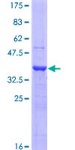 Abnova™ Human LOXL4 Partial ORF (NP_115587, 657 a.a. - 755 a.a.) Recombinant Protein with GST-tag at N-terminal