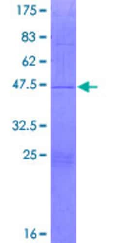 Abnova Human MRPL43 Full-length ORF (NP_115488.2, 1 a.a. - 159 a.a.) Recombinant Protein with GST-tag at N-terminal 2 &mu;g | Buy Online | Abnova&trade; | Fisher Scientific