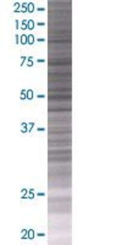 Abnova LYZL1 293T Cell Transient Overexpression Lysate (Denatured) 100 &mu;L | Buy Online | Abnova&trade; | Fisher Scientific