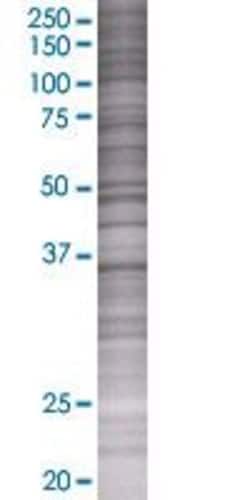 Abnova GNPTG 293T Cell Transient Overexpression Lysate (Denatured) 100 &mu;L | Buy Online | Abnova&trade; | Fisher Scientific