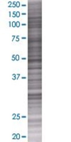 Abnova PARD6B 293T Cell Transient Overexpression Lysate (Denatured) 100 &mu;L | Buy Online | Abnova&trade; | Fisher Scientific