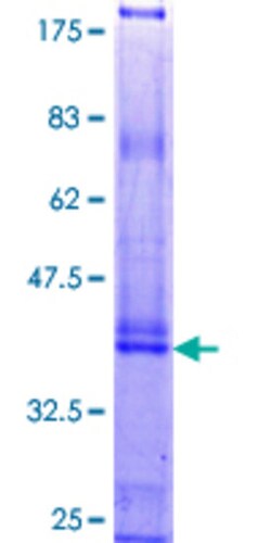 Abnova Human KRTAP4-4 Full-length ORF (NP_115913.1, 1 a.a. - 166 a.a.) Recombinant Protein with GST-tag at N-terminal 25 &mu;g | Buy Online | Abnova&trade; | Fisher Scientific