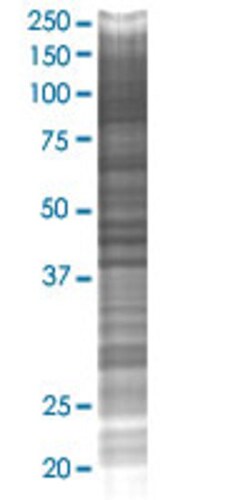 Abnova PLEKHA8 293T Cell Transient Overexpression Lysate (Denatured) (T02) 100 &mu;L | Buy Online | Abnova&trade; | Fisher Scientific