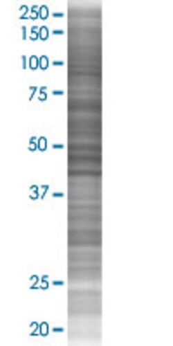 Abnova EFCAB4B 293T Cell Transient Overexpression Lysate (Denatured) (T02) 100 &mu;L | Buy Online | Abnova&trade; | Fisher Scientific