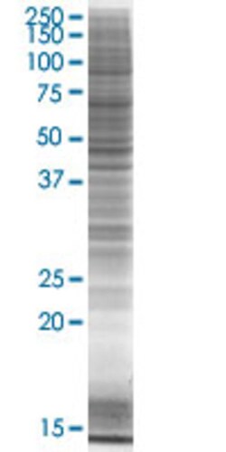 Abnova ZNF503 293T Cell Transient Overexpression Lysate (Denatured) (T03) 100 &mu;l | Buy Online | Abnova&trade; | Fisher Scientific