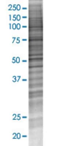 Abnova C9orf3 293T Cell Transient Overexpression Lysate (Denatured) (T03) 100 &mu;L | Buy Online | Abnova&trade; | Fisher Scientific