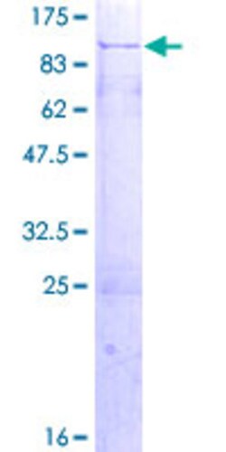 Abnova Human CIRH1A Full-length ORF (AAH09348.1, 1 a.a. - 686 a.a.) Recombinant Protein with GST-tag at N-terminal 2 &mu;g | Buy Online | Abnova&trade; | Fisher Scientific