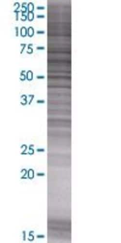 Abnova LRP11 293T Cell Transient Overexpression Lysate (Denatured) 100 &mu;L | Buy Online | Abnova&trade; | Fisher Scientific