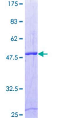 Abnova Human RAB2B Full-length ORF (NP_116235.2, 1 a.a. - 216 a.a.) Recombinant Protein with GST-tag at N-terminal 2 &mu;g | Buy Online | Abnova&trade; | Fisher Scientific
