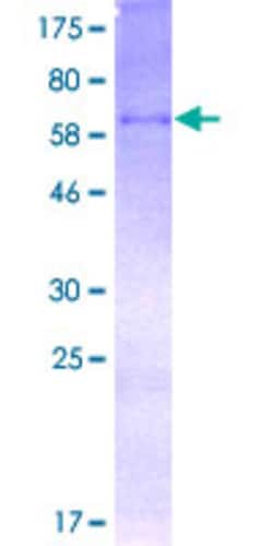 Abnova Human WNT3A Full-length ORF (AAI03922.1, 1 a.a. - 385 a.a.) Recombinant Protein with GST-tag at N-terminal 2 &mu;g | Buy Online | Abnova&trade; | Fisher Scientific