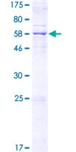 Abnova Human MCU Full-length ORF (NP_612366.1, 1 a.a. - 351 a.a.) Recombinant