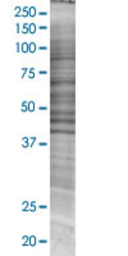 Abnova MTDH 293T Cell Transient Overexpression Lysate (Denatured) (T02) 100 &mu;L | Buy Online | Abnova&trade; | Fisher Scientific