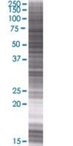 Abnova HSPB9 293T Cell Transient Overexpression Lysate (Denatured) 100 &mu;L | Buy Online | Abnova&trade; | Fisher Scientific