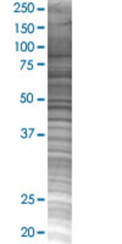 Abnova&trade;&nbsp;NLRP3 293T Cell Transient Overexpression Lysate (Denatured)