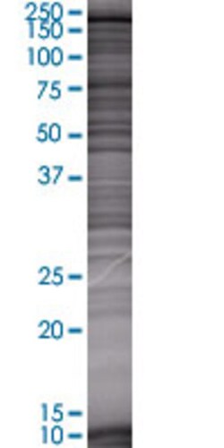 Abnova STK11IP 293T Cell Transient Overexpression Lysate (Denatured) 100&mu;L | Buy Online | Abnova&trade; | Fisher Scientific