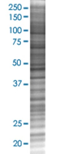 Abnova C1QTNF1 293T Cell Transient Overexpression Lysate (Denatured) (T02) 100&mu;L | Buy Online | Abnova&trade; | Fisher Scientific